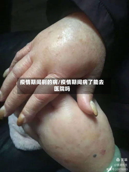 疫情期间别的病/疫情期间病了能去医院吗-第2张图片