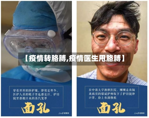 【疫情转胳膊,疫情医生甩胳膊】