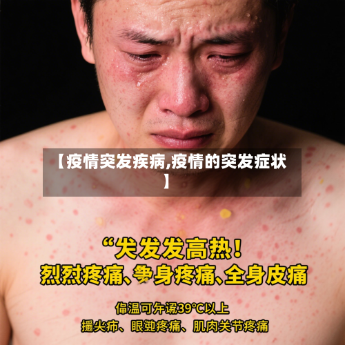 【疫情突发疾病,疫情的突发症状】-第2张图片