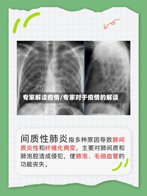 专家解读疫情/专家对于疫情的解读-第3张图片