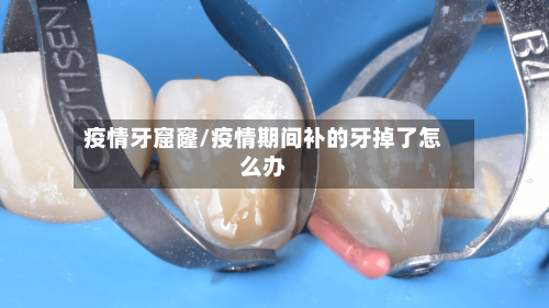 疫情牙窟窿/疫情期间补的牙掉了怎么办